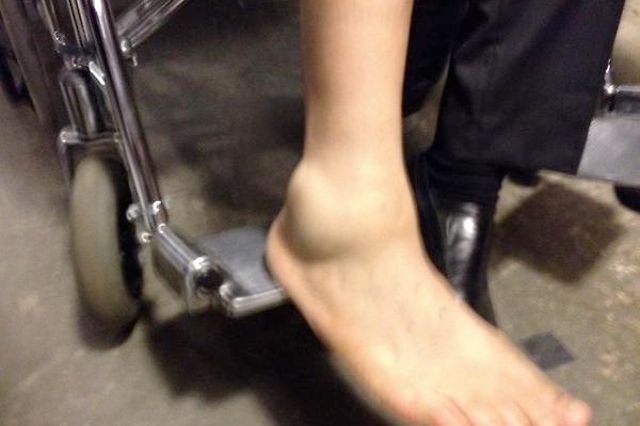 Mayor Cory Booker's ankle after he tripped on some kryptonite.
